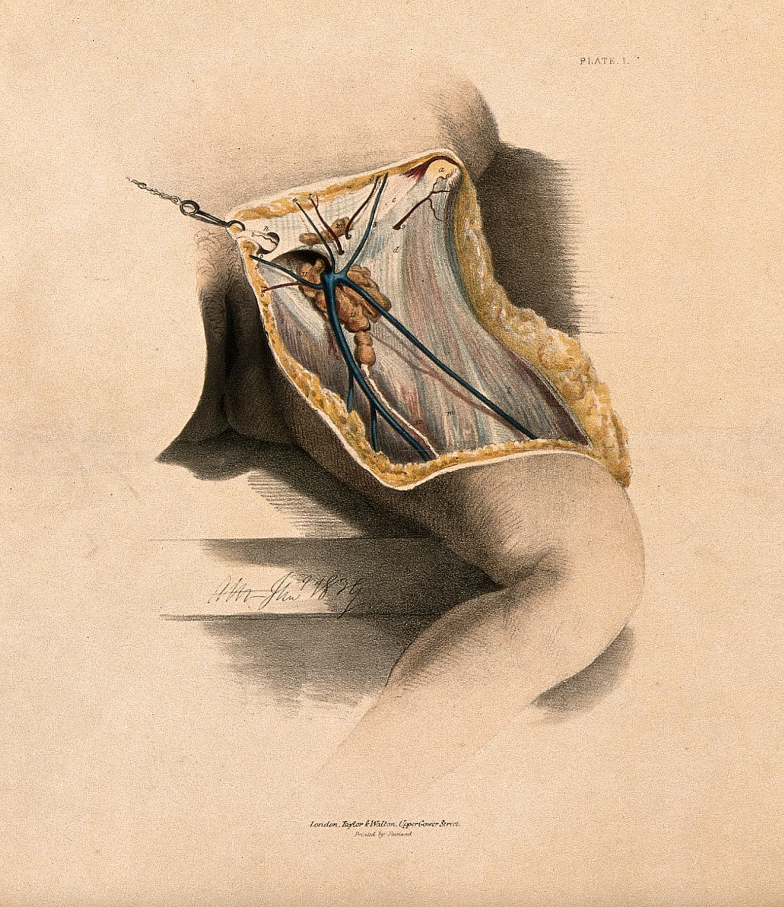 Hand-colored 1839 anatomical lithograph of a dissection showing the fascia, blood vessels, and lymphatic vessels of the human body