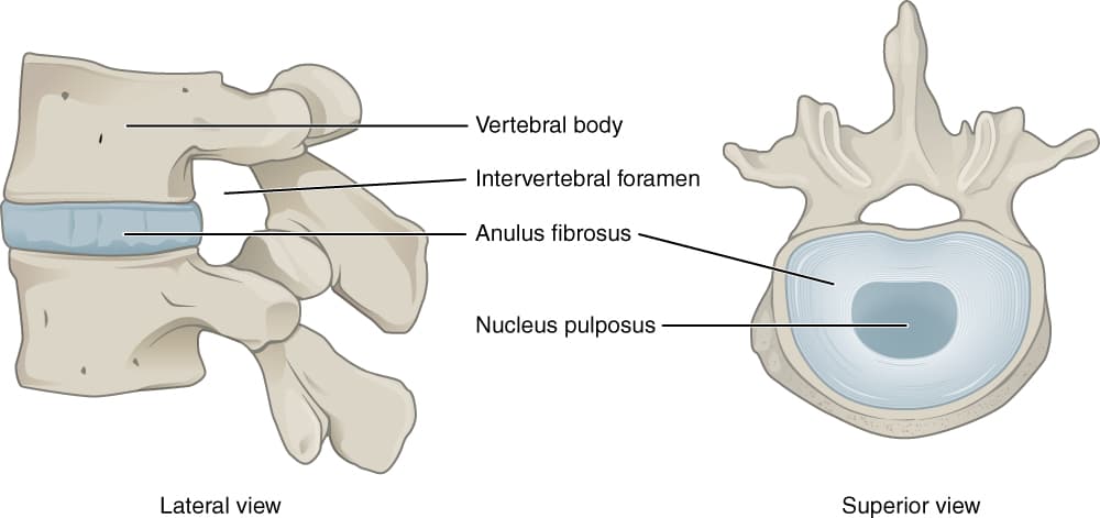 Diagram of an intervertebral disc showing the vertebral body, anulus fibrosus, and nucleus pulposus in lateral and superior views